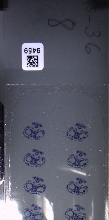 Media type: image; Special Collections 3102   shows specimen_part histological serial section;  Description: Whole slide scan, SC-3102, slide 8;